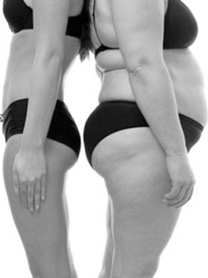 Obesidade em campo grande, mato grosso do sul